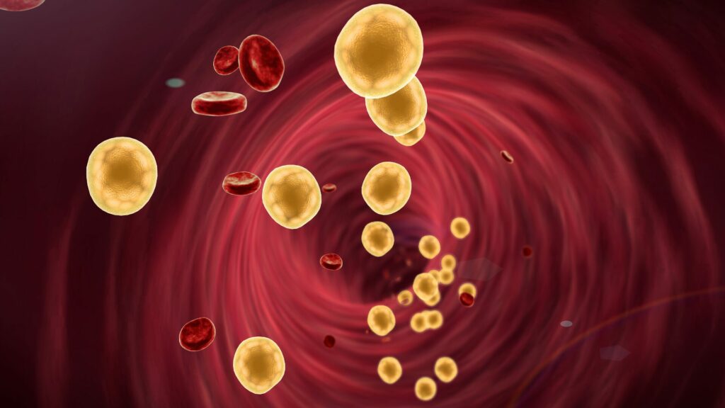 National Cholesterol Awareness Month - Why Pharmacogenomics Matters